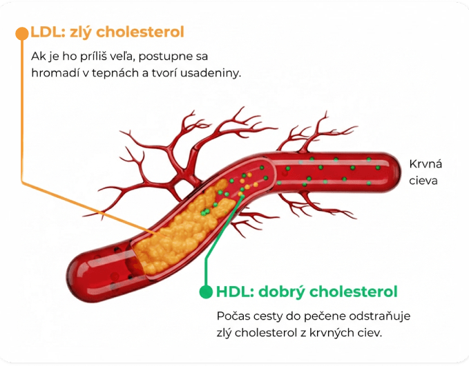 Ilustrácia LDL a HDL cholesterolu v cieve